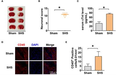Immunological characterization of stroke-heart syndrome and identification of inflammatory therapeutic targets